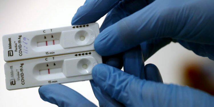 La Agencia del Medicamento pide la retirada de un test de antígenos por falsos positivos